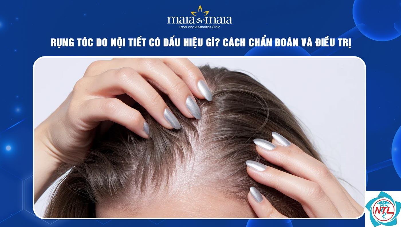 rụng tóc do nội tiết ở phụ nữ - Image 5