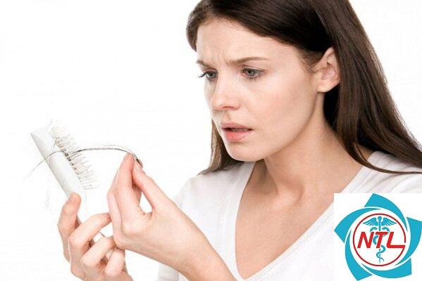 rụng tóc do nội tiết ở phụ nữ