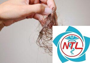 rụng tóc do thuốc