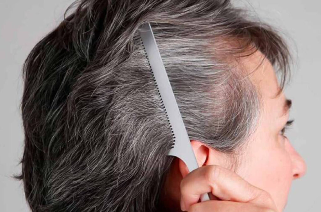 rụng tóc ở người cao tuổi