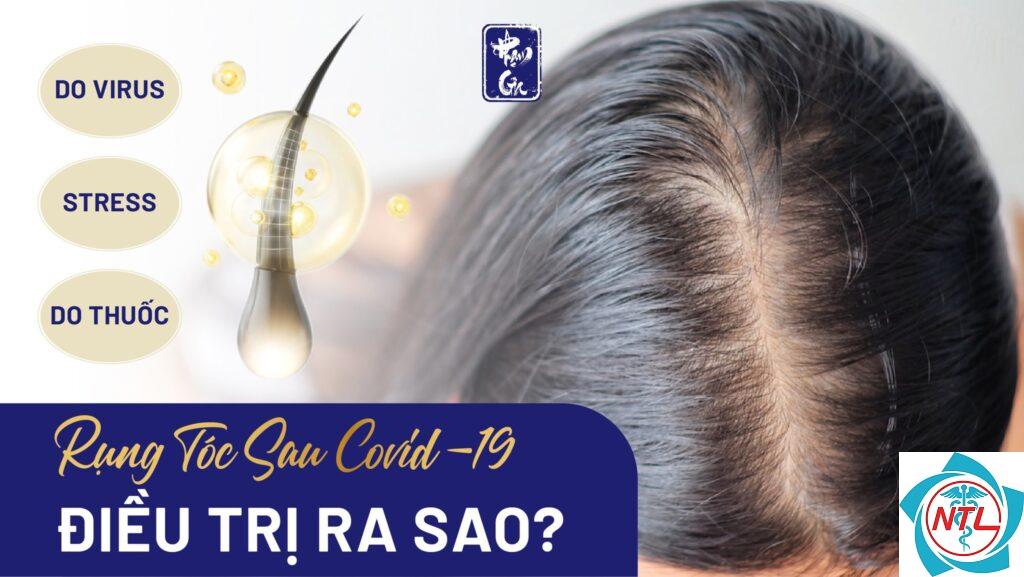 rụng tóc sau nhiễm virus