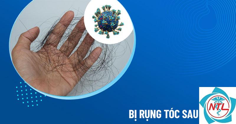 rụng tóc sau nhiễm virus - Image 2