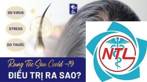 rụng tóc sau nhiễm virus
