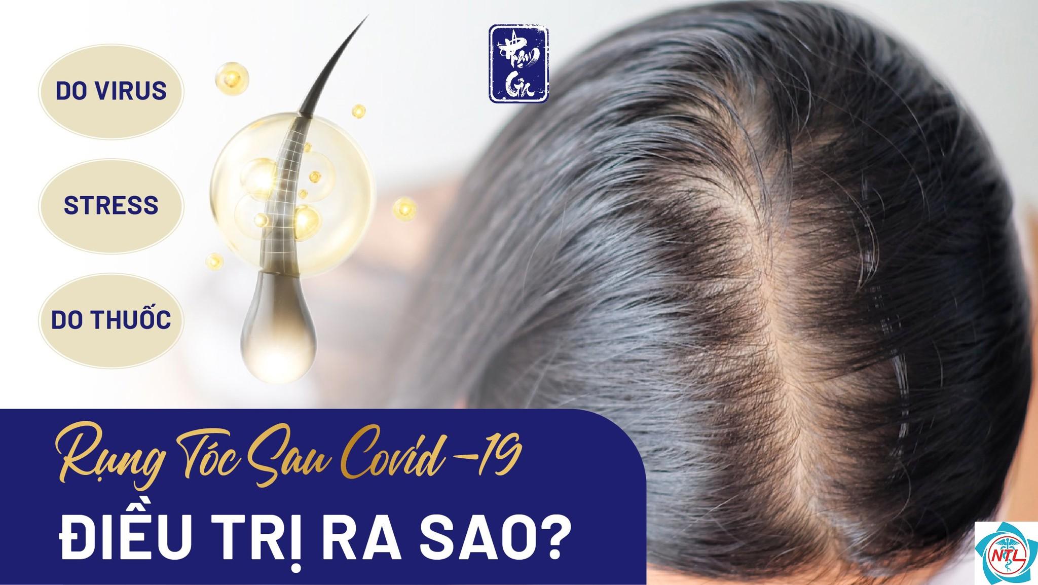 rụng tóc sau nhiễm virus - Image 1