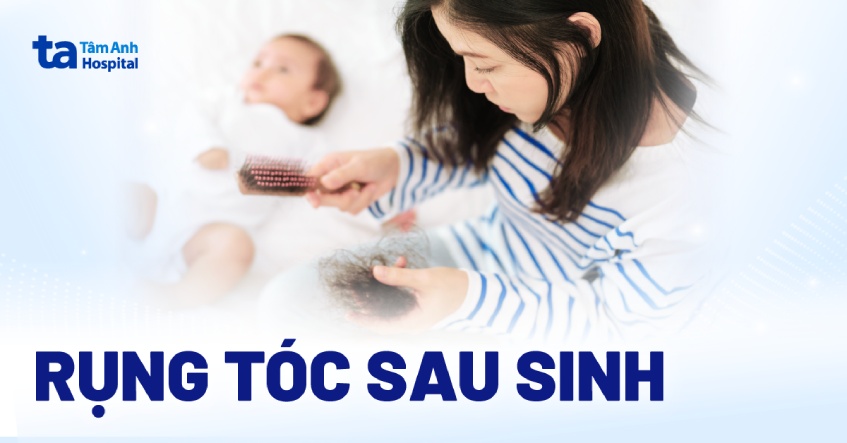 rụng tóc sau sinh - Image 4