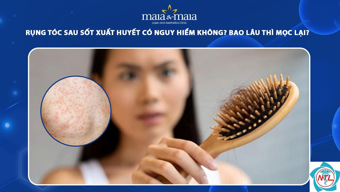 rụng tóc sau sốt - Image 3