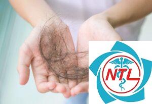 rụng tóc thời kỳ mãn kinh