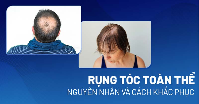 rụng tóc toàn thân - Image 5