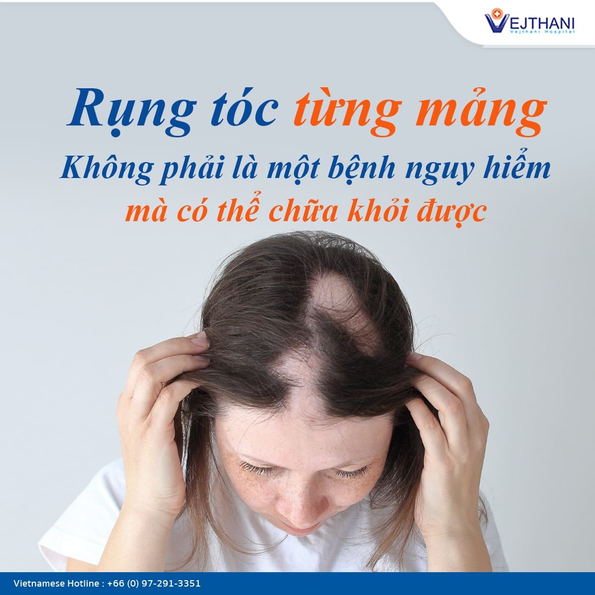 rụng tóc từng mảng - Image 4