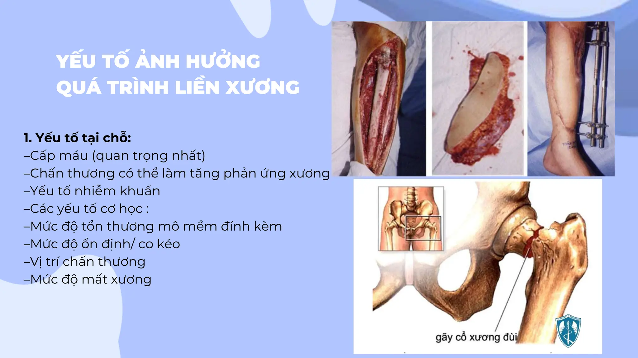 sinh lý liền xương - Image 2