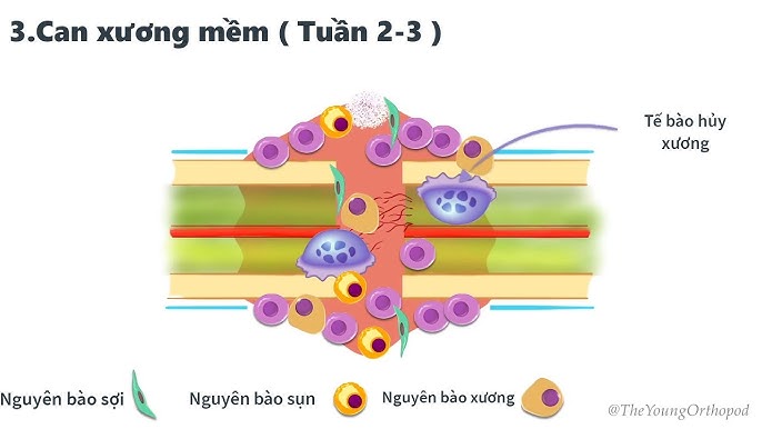 sinh lý liền xương - Image 4