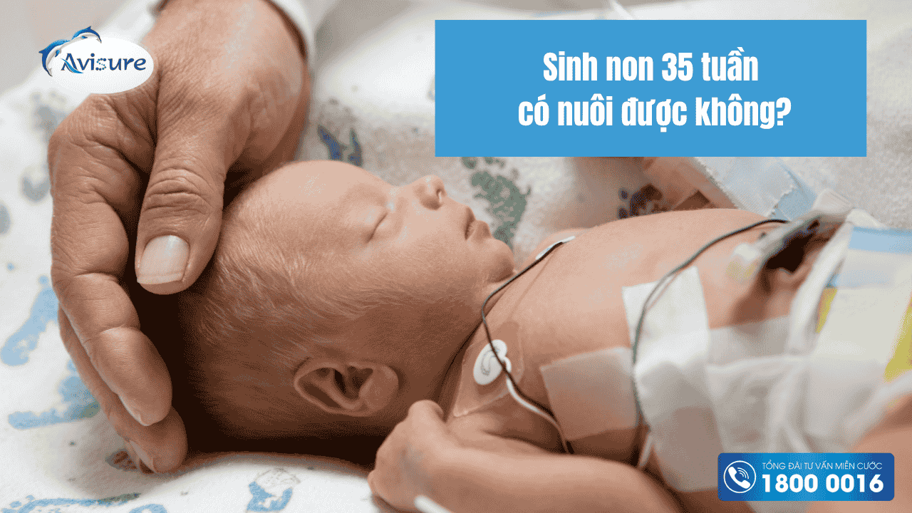 sinh non 35 tuần có nuôi được không - Image 3
