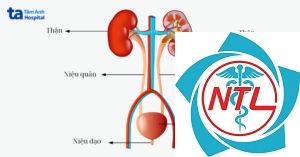 sơ đồ hệ tiết niệu