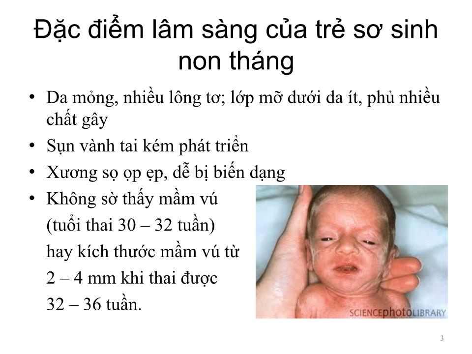 sơ sinh non tháng - Image 3