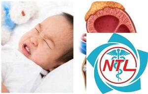 sỏi đường tiết niệu ở trẻ em