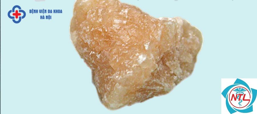 sỏi thận cystine - Image 5