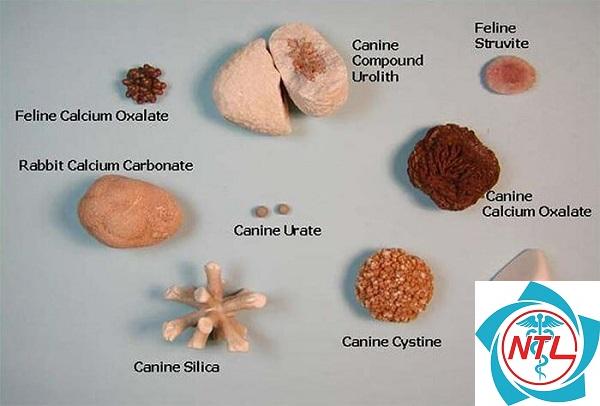 sỏi thận struvite - Image 4