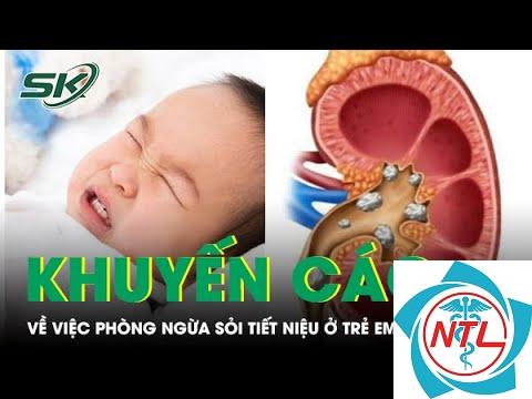 sỏi tiết niệu ở trẻ em - Image 4