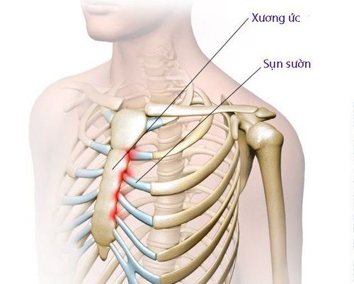 sung xuong - Image 2