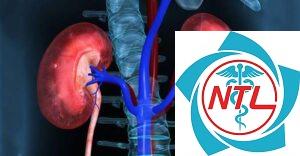 suy giảm chức năng thận