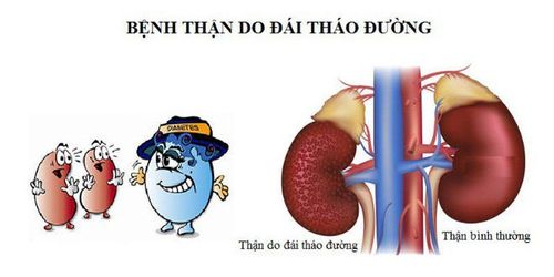 suy thận do tiểu đường - Image 4