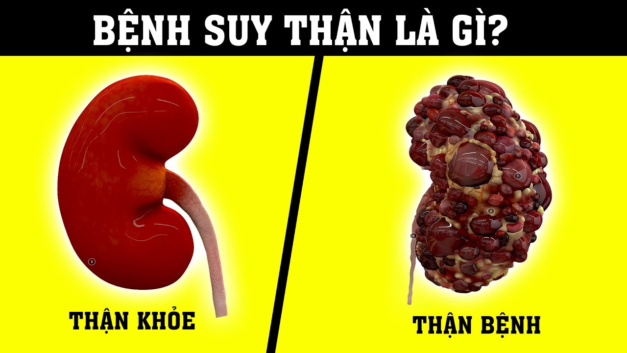 suy thận là gì - Image 2