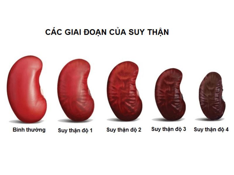 suy thận là gì - Image 5