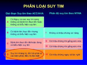 suy tim giai đoạn đầu