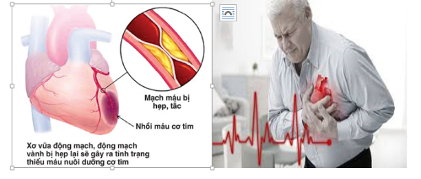 suy tim ở người tiểu đường