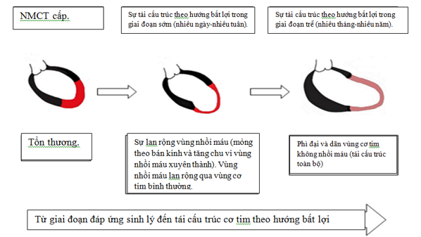 suy tim sau nhồi máu cơ tim - Image 3