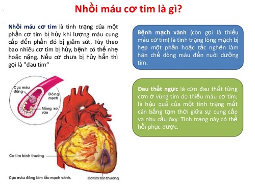 suy tim sau nhồi máu cơ tim - Image 4