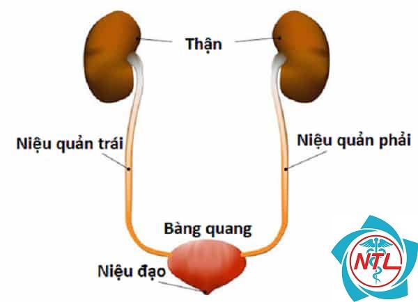tắc nghẽn niệu quản - Image 2