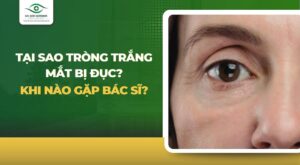 tại sao tròng trắng mắt bị đục
