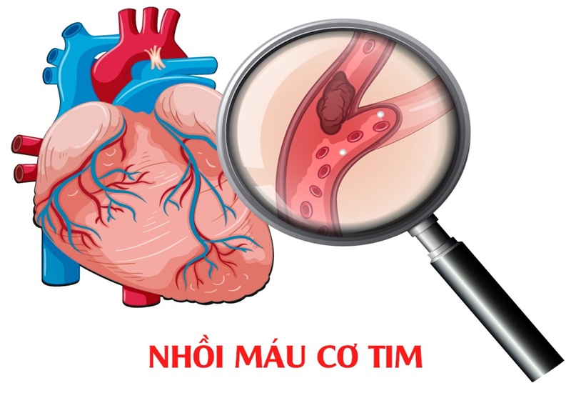 tăng huyết áp cần khám gì - Image 5