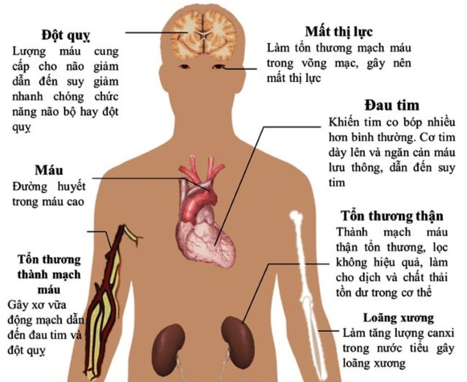 tăng huyết áp có nguy hiểm không - Image 4