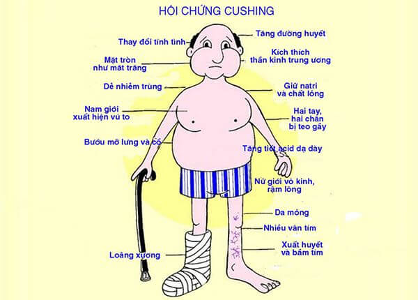 tăng huyết áp do rối loạn nội tiết - Image 3