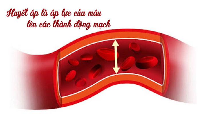 tăng huyết áp là gì - Image 2