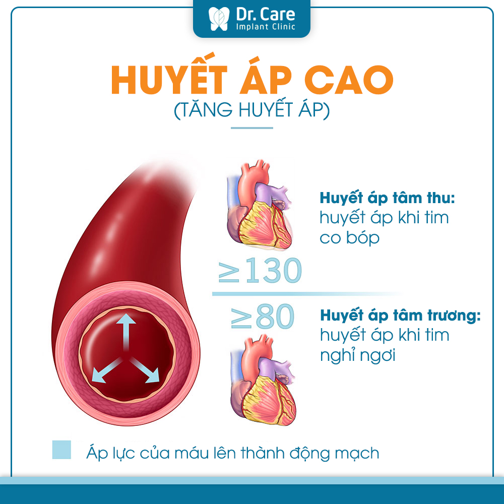 tăng huyết áp là gì