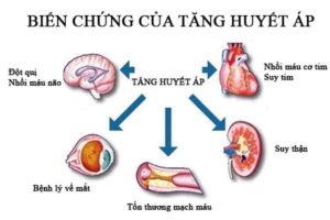 tăng huyết áp và suy tim ở người cao tuổi
