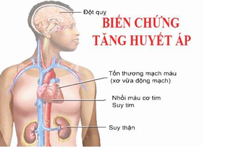 tăng huyết áp và suy tim ở người cao tuổi - Image 5
