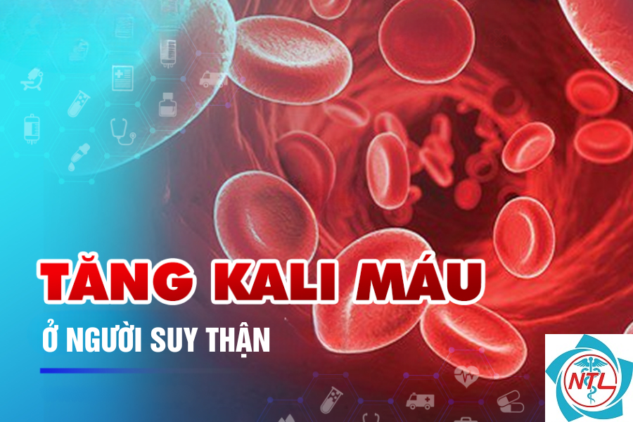 tăng kali máu do suy thận - Image 2