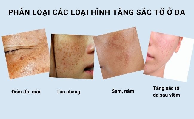tăng sắc tố da