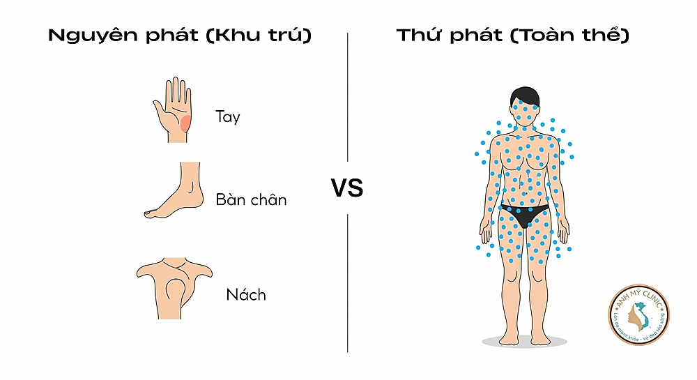 tăng tiết mồ hôi toàn thân - Image 5