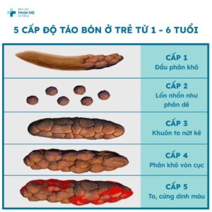 táo bón là gì