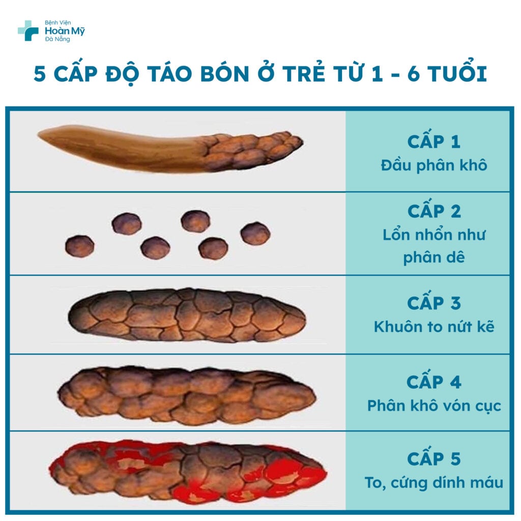 táo bón là gì