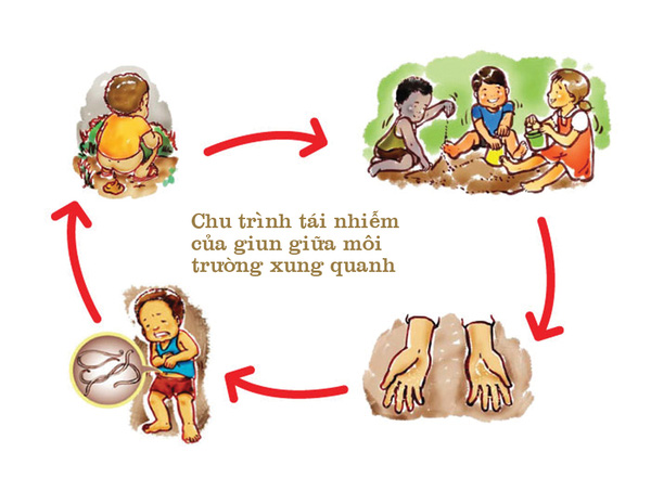 tẩy giun cho trẻ - Image 4
