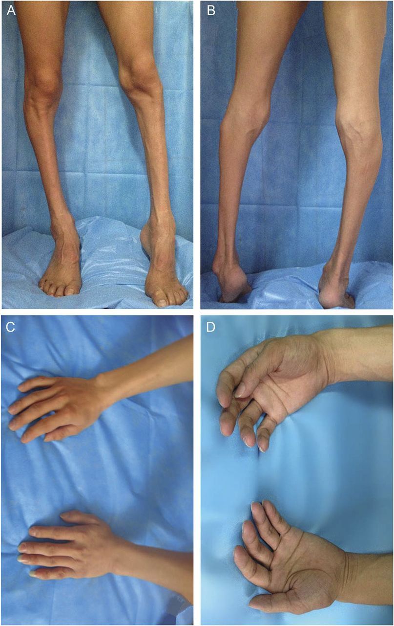 teo cơ có hồi phục được không - Image 3
