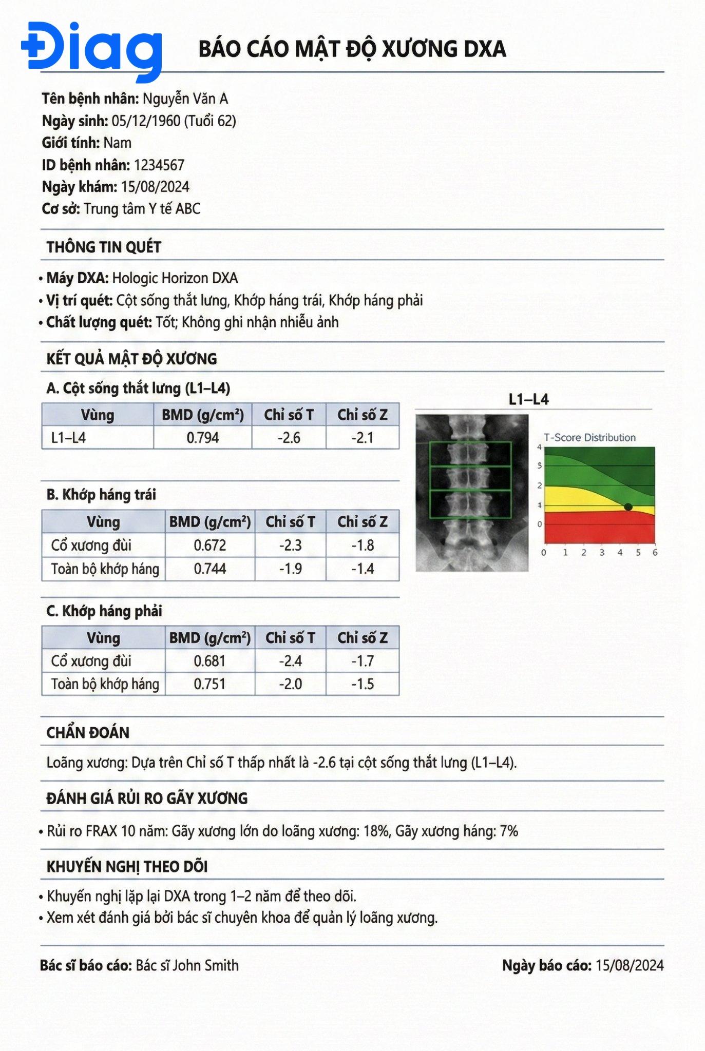 theo dõi mật độ xương - Image 3