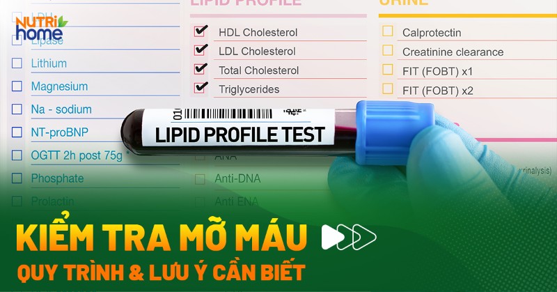 theo dõi mỡ máu định kỳ - Image 3