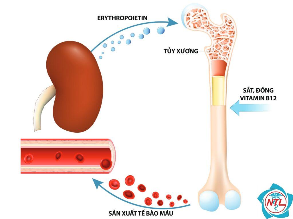 thiếu máu do suy thận